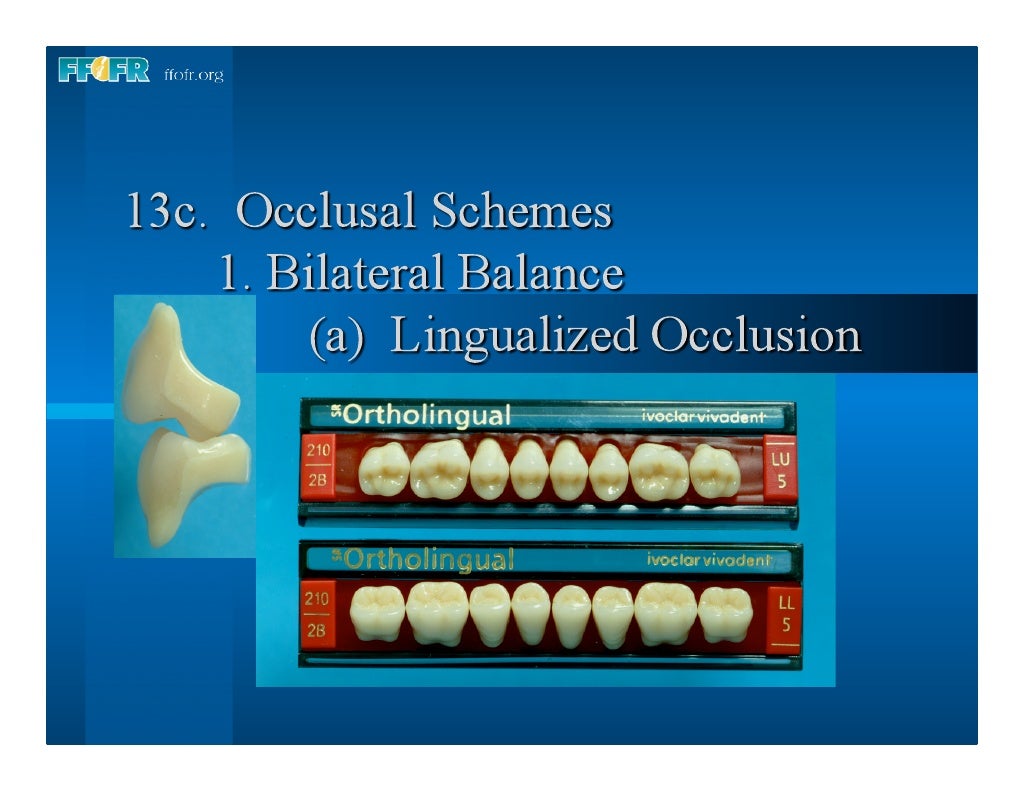16.occlusal schemes lingualized occlusion