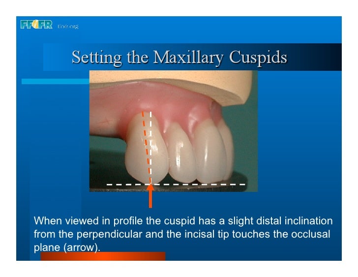 16.occlusal schemes lingualized occlusion
