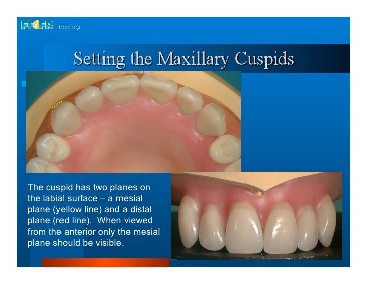 16.occlusal schemes lingualized occlusion