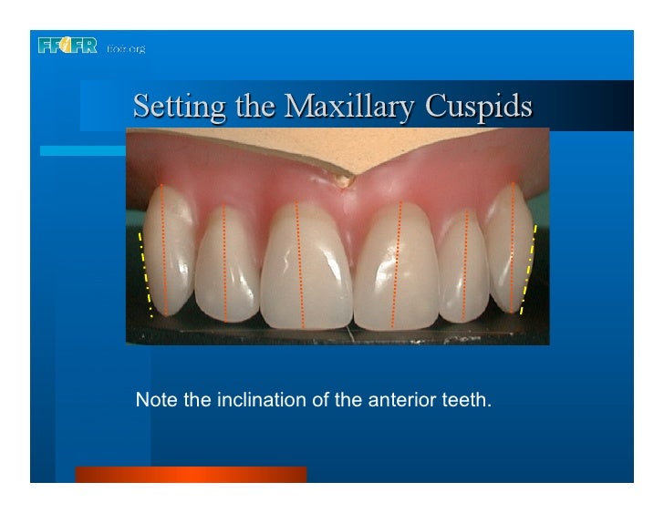 16.occlusal schemes lingualized occlusion