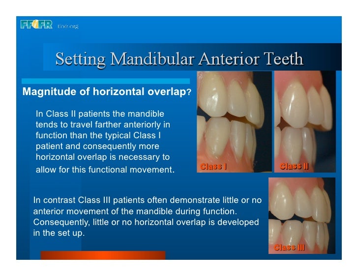 16.occlusal schemes lingualized occlusion