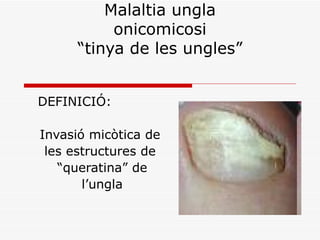 Malaltia ungla onicomicosi “tinya de les ungles” DEFINICIÓ: Invasió micòtica de les estructures de  “ queratina” de l’ungla 
