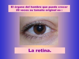 El órgano del hombre que puede crecer
    20 veces su tamaño original es :




           La retina.
 