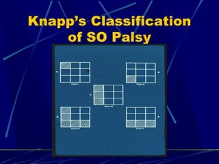 Knapp’s Classification
of SO Palsy
 