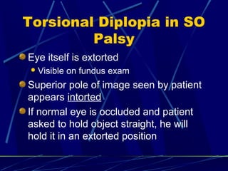 Torsional Diplopia in SO
Palsy
Eye itself is extorted
Visible on fundus exam
Superior pole of image seen by patient
appears intorted
If normal eye is occluded and patient
asked to hold object straight, he will
hold it in an extorted position
 