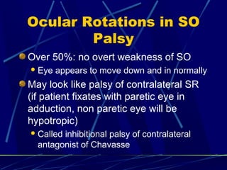Ocular Rotations in SO
Palsy
Over 50%: no overt weakness of SO
Eye appears to move down and in normally
May look like palsy of contralateral SR
(if patient fixates with paretic eye in
adduction, non paretic eye will be
hypotropic)
Called inhibitional palsy of contralateral
antagonist of Chavasse
 