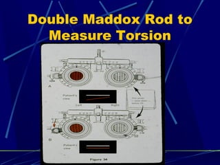 Double Maddox Rod to
Measure Torsion
 