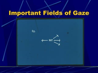 Important Fields of Gaze
 