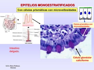Intestino
delgado.
EPITELIOS MONOESTRATIFICADOS
Con células prismáticas con microvellosidades
Célula glandular
caliciforme
Celula prismática con
microvellosidades
I.E.S. Otero Pedrayo.
Ourense
 