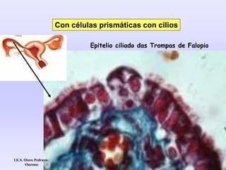 Con células prismáticas con cilios
Epitelio ciliado das Trompas de Falopio
I.E.S. Otero Pedrayo.
Ourense
 