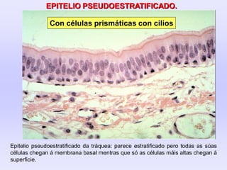EPITELIO PSEUDOESTRATIFICADO.
Epitelio pseudoestratificado da tráquea: parece estratificado pero todas as súas
células chegan á membrana basal mentras que só as células máis altas chegan á
superficie.
Con células prismáticas con cilios
 