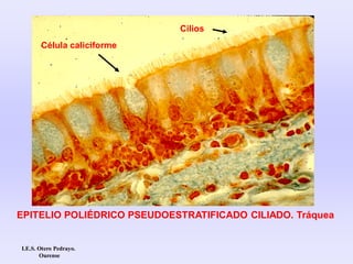 EPITELIO POLIÉDRICO PSEUDOESTRATIFICADO CILIADO. Tráquea
Célula caliciforme
Cilios
I.E.S. Otero Pedrayo.
Ourense
 