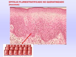 EPITELIO PLURIESTRATIFICADO NO QUERATINIZADO
(mucosas)
 