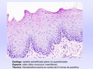 Esófago: epitelio estratificado plano no queratinizado
Especie: ratón (Mus musculus; mamíferos)
Técnica: Hematoxilina-eosina en cortes de 8 micras de parafina.
 