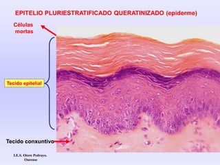 Células
mortas
EPITELIO PLURIESTRATIFICADO QUERATINIZADO (epiderme)
I.E.S. Otero Pedrayo.
Ourense
Tecido conxuntivo
Tecido epitelial
 