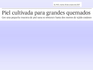 http://www.elpais.com/articulo/salud/Piel/cultivada/grandes/quemados/elpepu
sal/20071030elpepisal_1/Tes
 