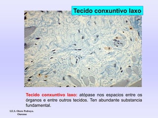 Tecido conxuntivo laxo: atópase nos espacios entre os
órganos e entre outros tecidos. Ten abundante substancia
fundamental.
Tecido conxuntivo laxo
I.E.S. Otero Pedrayo.
Ourense
 