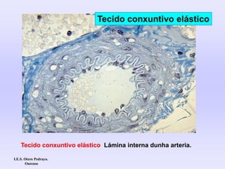 Tecido conxuntivo elástico Lámina interna dunha arteria.
Tecido conxuntivo elástico
I.E.S. Otero Pedrayo.
Ourense
 