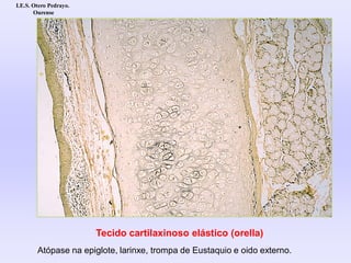 Tecido cartilaxinoso elástico (orella)
Atópase na epiglote, larinxe, trompa de Eustaquio e oido externo.
I.E.S. Otero Pedrayo.
Ourense
 