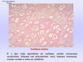 Cartilaxe hialino
É o tipo máis abundante de cartilaxe: contén numerosos
condrocitos. Atópase nas articulacións, nariz, traquea, bronquios,
cordas vocales e entre as vértebras.
I.E.S. Otero Pedrayo.
Ourense
 