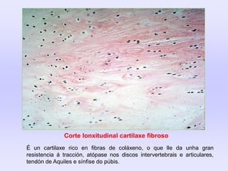 Corte lonxitudinal cartilaxe fibroso
É un cartilaxe rico en fibras de coláxeno, o que lle da unha gran
resistencia á tracción, atópase nos discos intervertebrais e articulares,
tendón de Aquiles e sínfise do púbis.
 