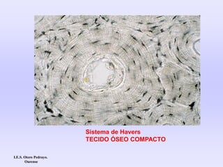 Sistema de Havers
TECIDO ÓSEO COMPACTO
I.E.S. Otero Pedrayo.
Ourense
 