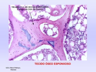 TECIDO ÓSEO ESPONXOSO
I.E.S. Otero Pedrayo.
Ourense
 