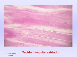 Tecido muscular estriadoI.E.S. Otero Pedrayo.
Ourense
 