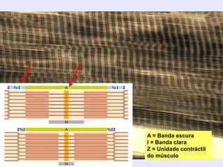 A = Banda escura
I = Banda clara
Z = Unidade contráctil
do músculo
 