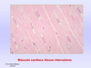 Músculo cardiaco discos intercalares
I.E.S. Otero Pedrayo.
Ourense
 