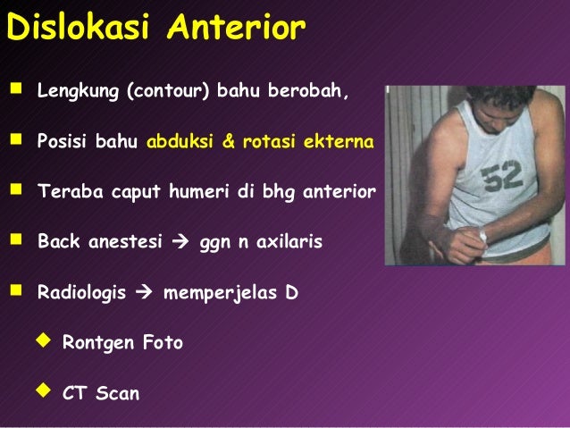 16 trauma-sendi-10-april-2013