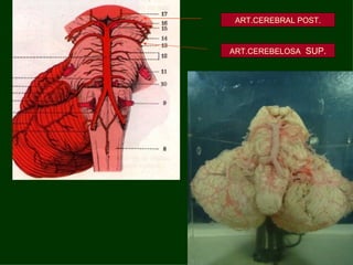 ART.CEREBRAL POST. ART.CEREBELOSA   SUP. 