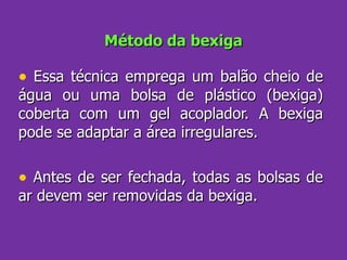 Método da bexiga Essa técnica emprega um balão cheio de água ou uma bolsa de plástico (bexiga) coberta com um gel acoplador. A bexiga pode se adaptar a área irregulares. Antes de ser fechada, todas as bolsas de ar devem ser removidas da bexiga. 