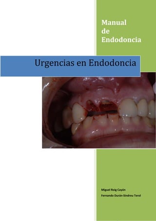 Manual 
               de 
               Endodoncia 


Urgencias en Endodoncia




               Miguel Roig Cayón 
               Fernando Durán‐Sindreu Terol 




                                    1
 