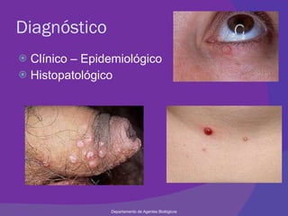 Diagnóstico Clínico – Epidemiológico Histopatológico  Departamento de Agentes Biológicos 