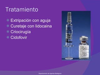 Tratamiento Extripación con aguja Curetaje con lidocaina Criocirugía Cidofovir Departamento de Agentes Biológicos