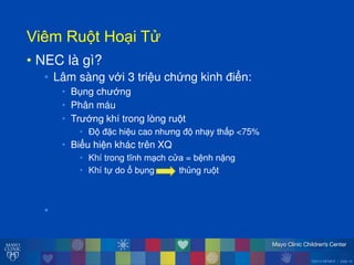 ©2014 MFMER | slide-16
ViêmăRu tăHo iăT
• NEC là gì?
• Lâm sàng với 3 triệu chứng kinh điển:
• Bụng ch ớng
• Phân máu
• Tr ớng khí trong lòng ru t
• Đ đặc hiệu cao nh ng đ nh y thấp <75%
• Biểu hiện khác trên XQ
• Khí trong tĩnh m ch c a = bệnh nặng
• Khí tự doăổăbụng thủng ru t
•
 