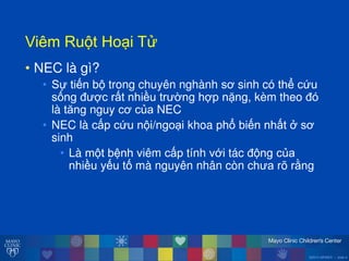 ©2014 MFMER | slide-4
ViêmăRu tăHo iăT
• NEC là gì?
• Sự tiến b trong chuyên nghành sơ sinh có thể cứu
sống đ ợc rất nhiều tr ờng hợp nặng, kèm theo đó
là tĕng nguy cơ của NEC
• NEC là cấp cứu n i/ngo i khoa phổ biến nhất ởăsơ
sinh
• Là m t bệnh viêm cấp tính với tác đ ng của
nhiều yếu tố mà nguyên nhân còn ch a rõ rằng
 