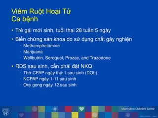 ©2014 MFMER | slide-5
ViêmăRu tăHo iăT
Caăbệnh
• Trẻ gái mới sinh, tuổi thai 28 tuần 5 ngày
• Biến chứng sản khoa do s dụng chất gây nghiện
• Methamphetamine
• Marijuana
• Wellbutrin, Seroquel, Prozac, and Trazodone
• RDS sau sinh, cần phải đặt NKQ
• Thở CPAP ngày thứ 1 sau sinh (DOL)
• NCPAP ngày 1-11 sau sinh
• Oxy gọng ngày 12 sau sinh
 