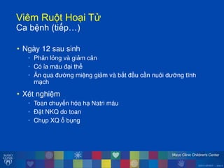 ©2014 MFMER | slide-6
ViêmăRu tăHo iăT
Caăbệnhă(tiếp…)
• Ngày 12 sau sinh
• Phân lỏng và giảm cân
• Có ỉa máu đ i thể
• Ĕn qua đ ờng miệng giảm và bắt đầu cần nuôi d ỡng tĩnh
m ch
• Xét nghiệm
• Toan chuyển hóa h Natri máu
• Đặt NKQ do toan
• Chụp XQăổăbụng
 