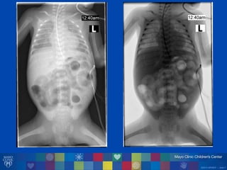 ©2014 MFMER | slide-7
 