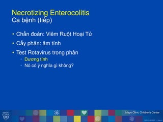 ©2014 MFMER | slide-9
Necrotizing Enterocolitis
Caăbệnhă(tiếp)
• Chẩn đoán: Viêm Ru t Ho i T
• Cấy phân: âm tính
• Test Rotavirus trong phân
• D ơng tính
• Nó có ý nghĩa gì không?
 