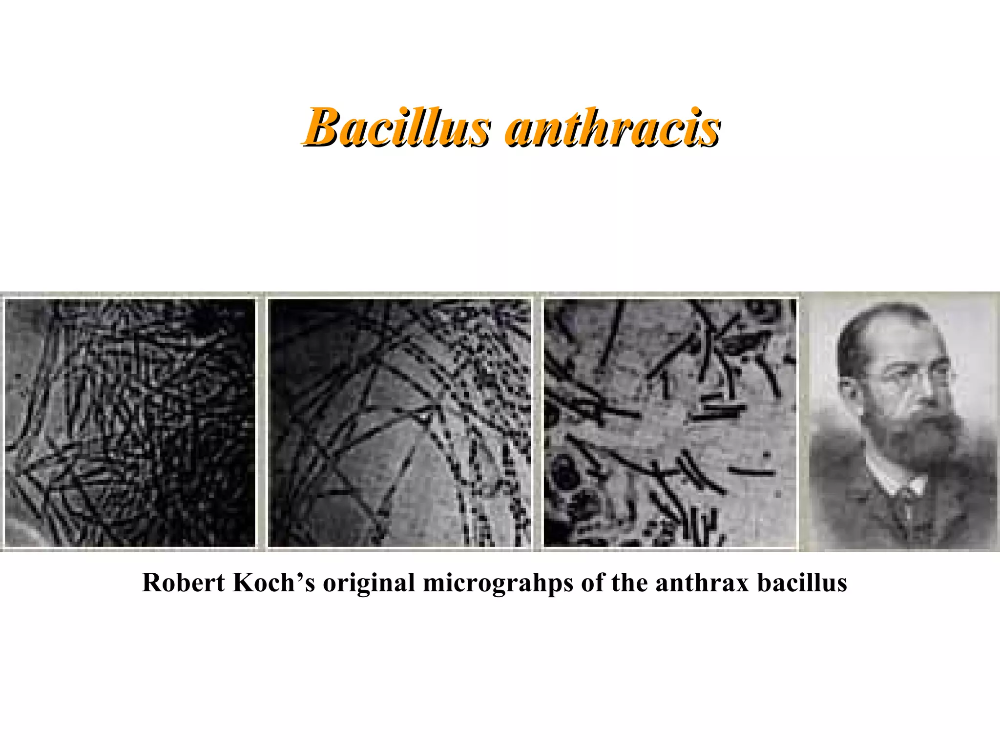 Bacillus anthracisBacillus anthracis
Robert Koch’s original micrograhps of the anthrax bacillus
 