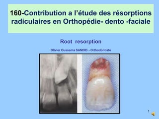 160-Contribution a l’étude des résorptions
radiculaires en Orthopédie- dento -faciale
Root resorption
Olivier Oussama SANDID - Orthodontiste
1
 