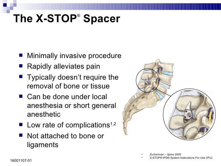 16001107 01 X Stop Surgeon To Patient Final