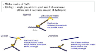 • Milder version of DMD
• Etiology ▫ single gene defect ▫ short arm X chromosome
▫ altered size & decreased amount of dystrophin
 