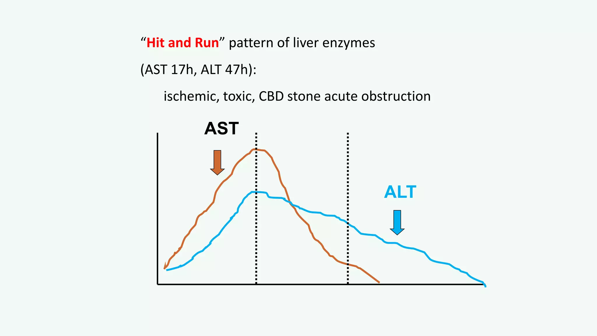 “Hit and Run” pattern of liver enzymes
(AST 17h, ALT 47h):
ischemic, toxic, CBD stone acute obstruction
AST
ALT
 