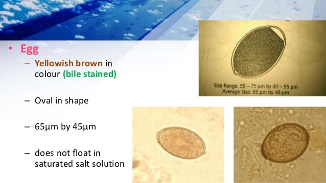 Cestodes By Dr Rakesh Prasad Sah