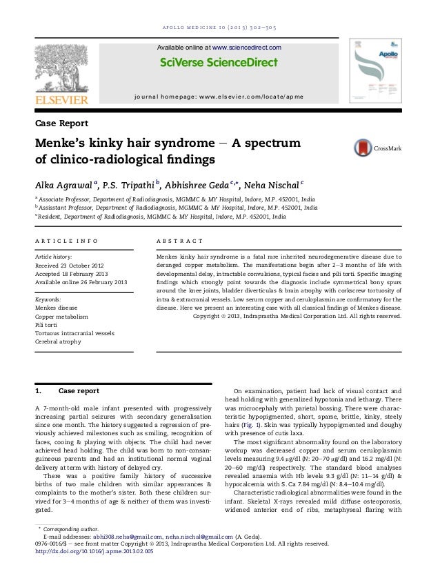 Menke S Kinky Hair Syndrome A Spectrum Of Clinico Radiological Find