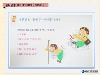 골다공증 (OSTEOPOROSIS)
 
